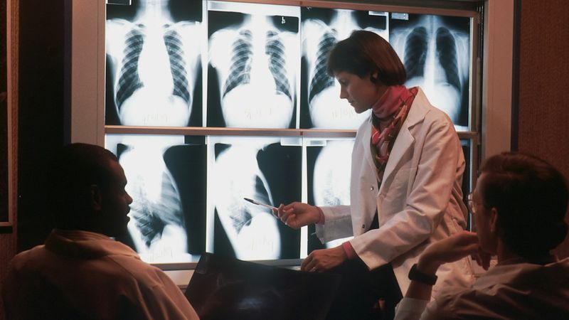 A woman in a white coat points to chest X-rays on a lightbox while two colleagues look on